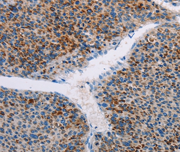 AMOTL2 Antibody