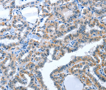 ACE2 Antibody