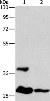 ANKRD54 Antibody