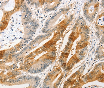 ANAPC2 Antibody