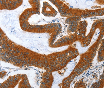 ANAPC10 Antibody