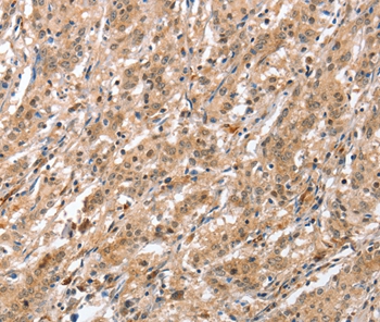 ATG12 Antibody