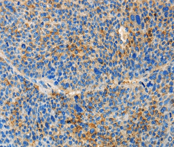 TNFSF13 Antibody