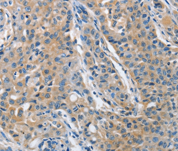 TNFSF13 Antibody