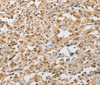 AMZ2 Antibody