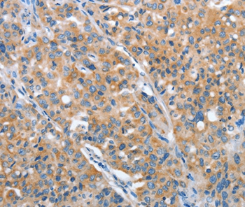 ARFGAP1 Antibody