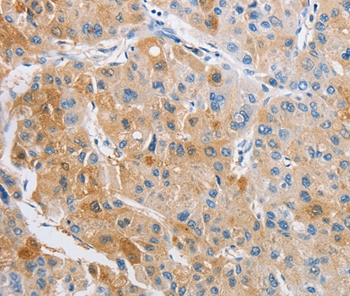 ARHGAP5 Antibody