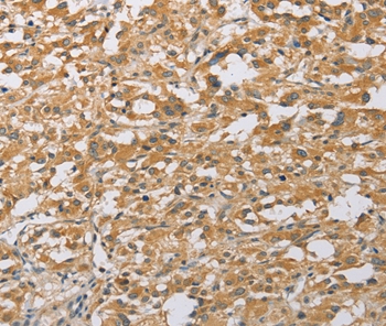 ARHGEF1 Antibody