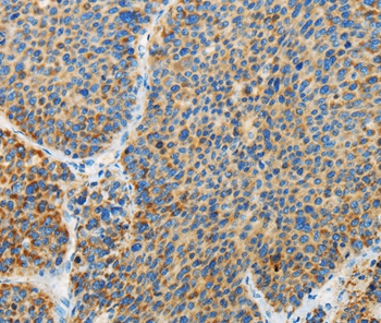 ARHGEF3 Antibody