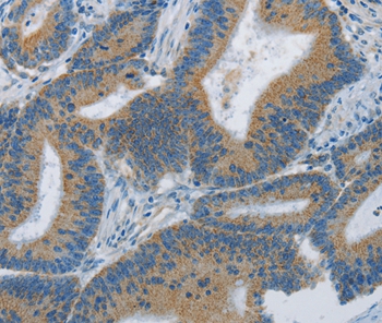 ARHGEF3 Antibody