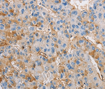 DIRAS3 Antibody