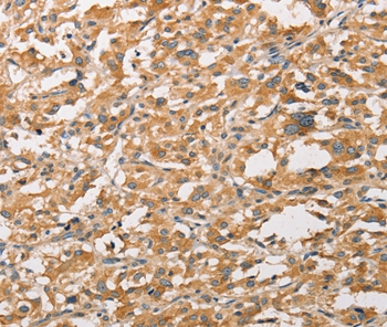 WNT11 Antibody