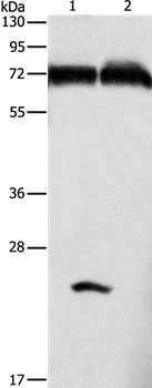 GDPD5 Antibody