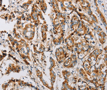 IFITM3 Antibody