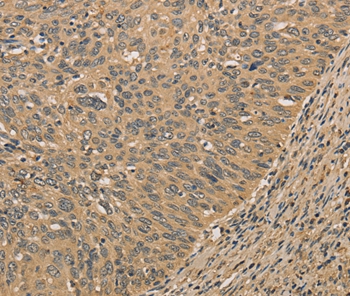 PRDM14 Antibody