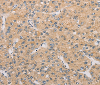 ATG4D Antibody