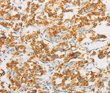 IDH3G Antibody