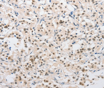 SAE1 Antibody