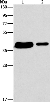 SAE1 Antibody