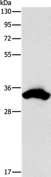 CDCA8 Antibody