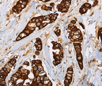 TLR6 Antibody