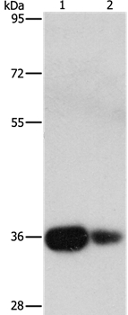 UCHL5 Antibody