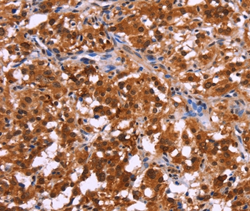 USP2 Antibody