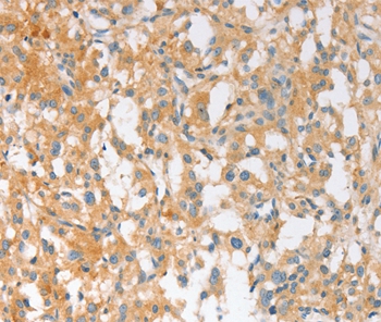 EPS15L1 Antibody