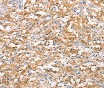 UBQLN1 Antibody