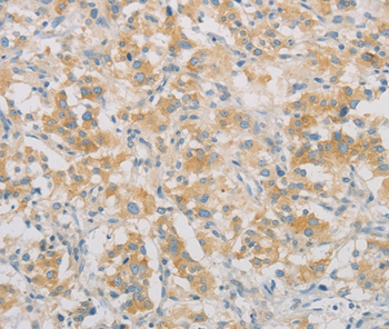 SPTLC1 Antibody