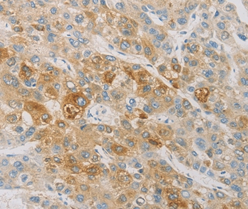 ACSL4 Antibody