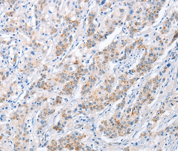 PAPSS1 Antibody