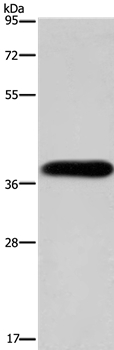 PITX2 Antibody