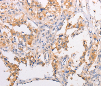 MYLK3 Antibody