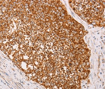 AK2 Antibody