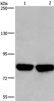 PFKP Antibody