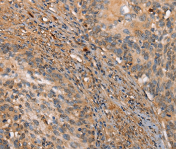 HK3 Antibody