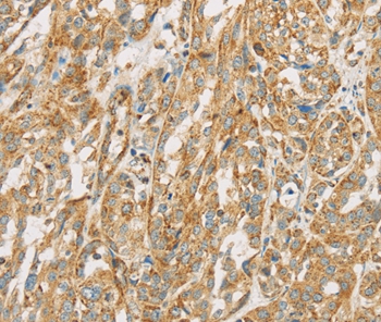 NPPB Antibody