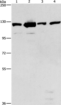 PTK2 Antibody