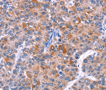 ELP2 Antibody