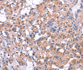 ELP2 Antibody