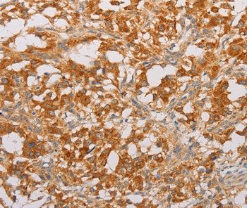 BNIP3 Antibody