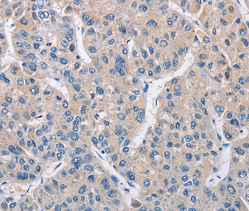 MTMR4 Antibody