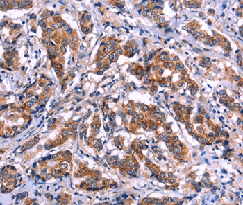 EIF2AK4 Antibody