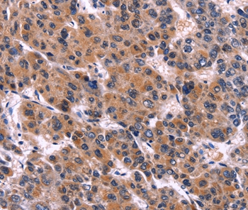 EIF2AK4 Antibody