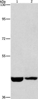 CSNK1E Antibody