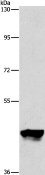 PIP4K2A Antibody