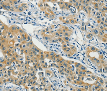 ASAH2 Antibody