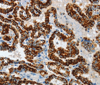 ASB4 Antibody