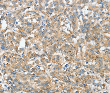 ASCC1 Antibody